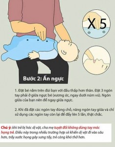 Sơ cứu trẻ bị sặc cháo, sữa tại nhà: Điều phải biết - Ảnh 2